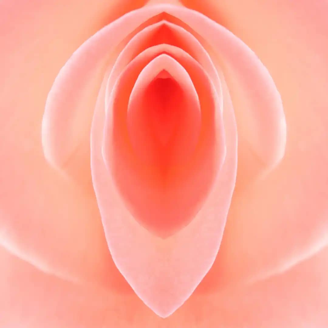 Ninfoplastia resolve a hipertrofia dos pequenos lábios?